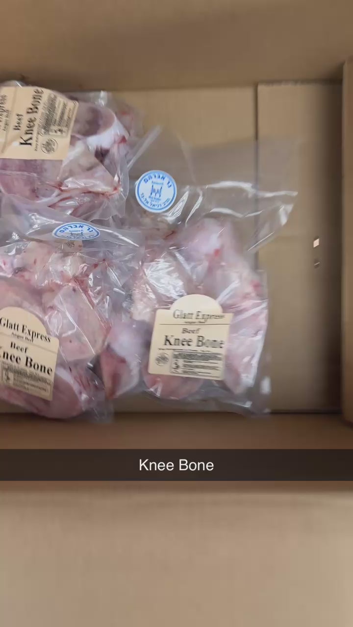 Knee Bone